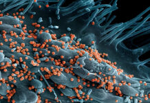 Lujo virüsü: %80 ölüm oranıyla gelen sessiz tehlike